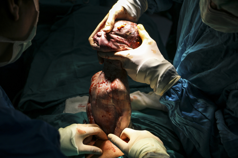 o an von Ahmet Durmaz