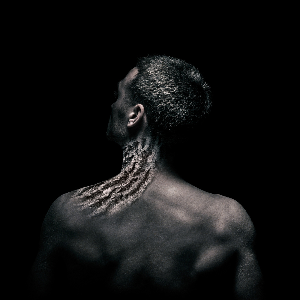 Torticollis von Cristian Frumusanu