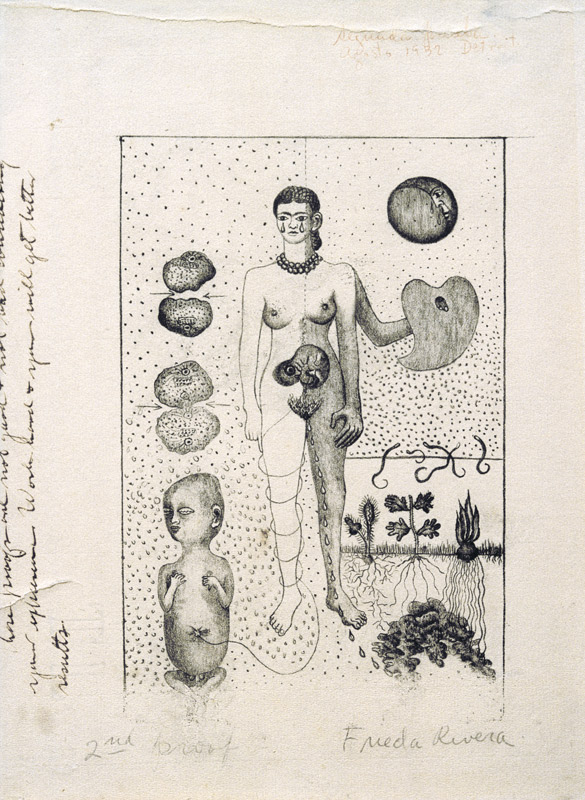 Frida and the Miscarriage von Frida Kahlo