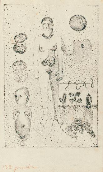 Frida Kahlo and the Miscarriage