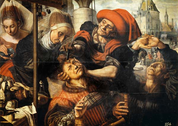 The Surgeon von Jan Sanders van Hemessen