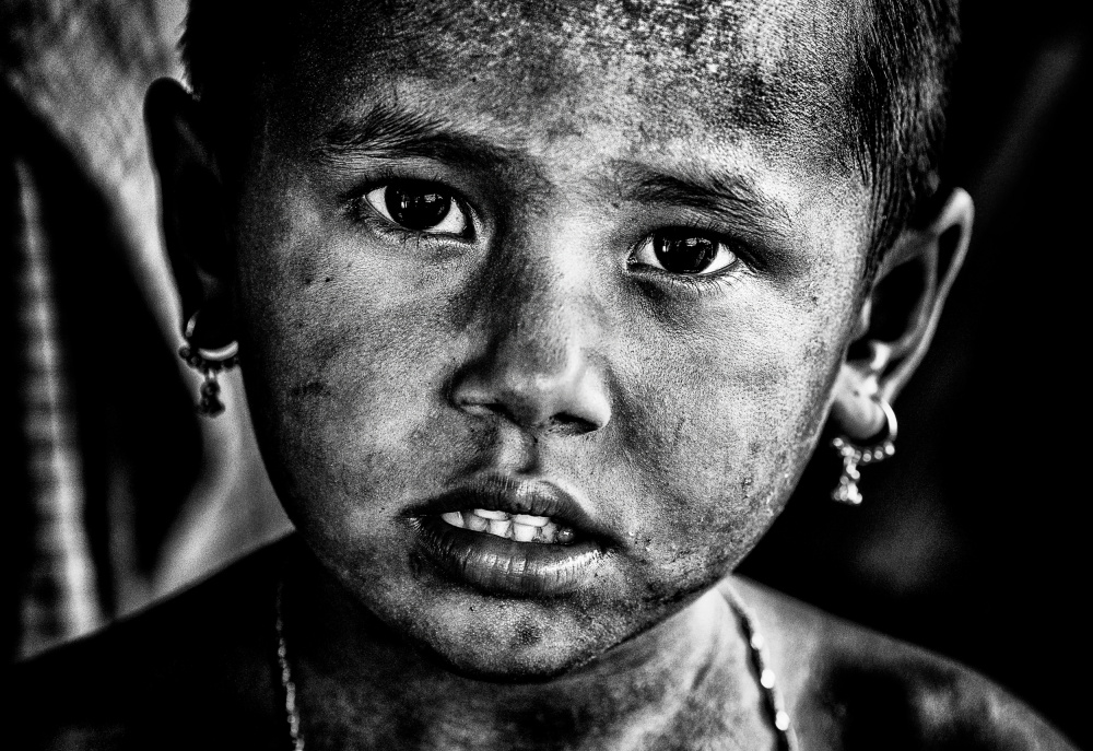 Rohingya refugee girl - Bangladesh von Joxe Inazio Kuesta Garmendia
