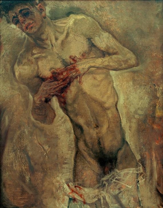 The Bleeding Man von Max Oppenheimer