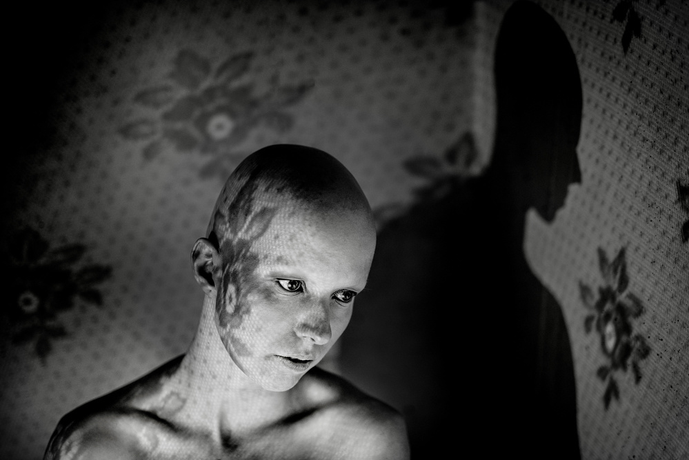 Alopecia von Miloš Nejezchleb