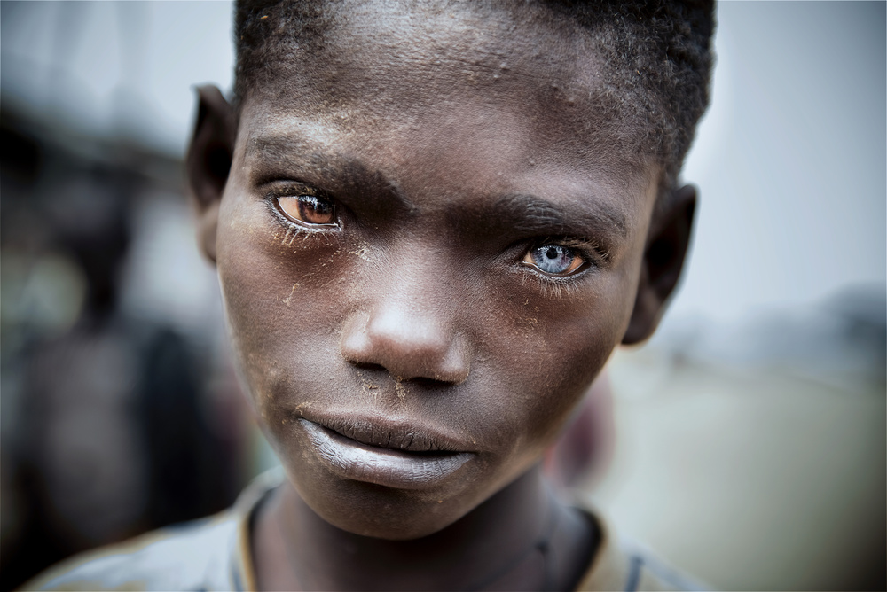 The burden of difference von Trevor Cole